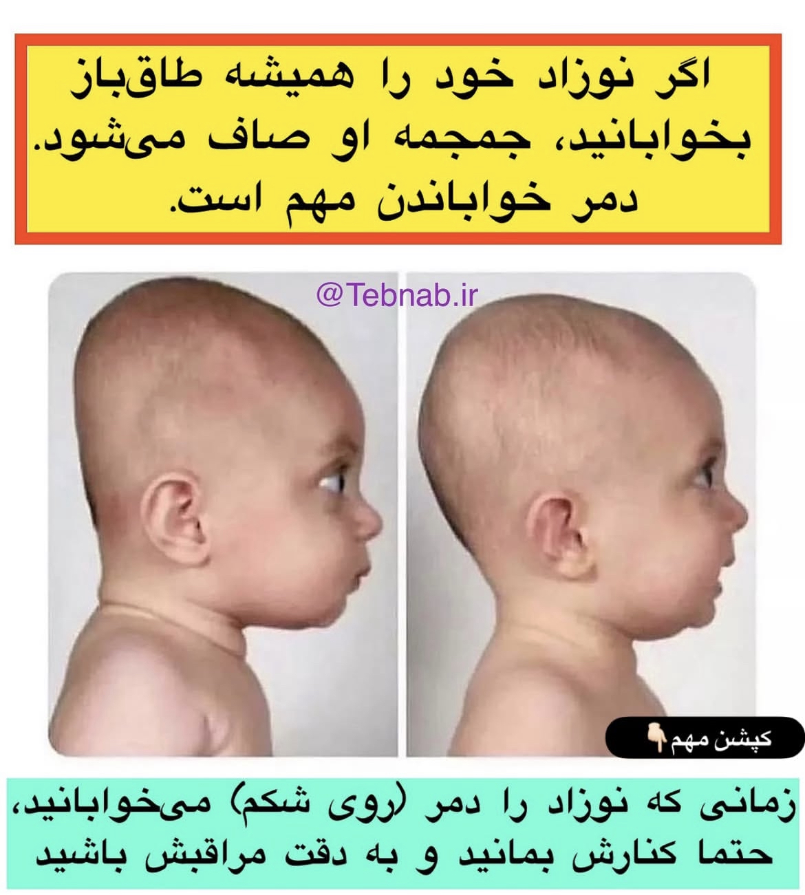 خطر طاق&zwnj;باز خواباندن نوزاد