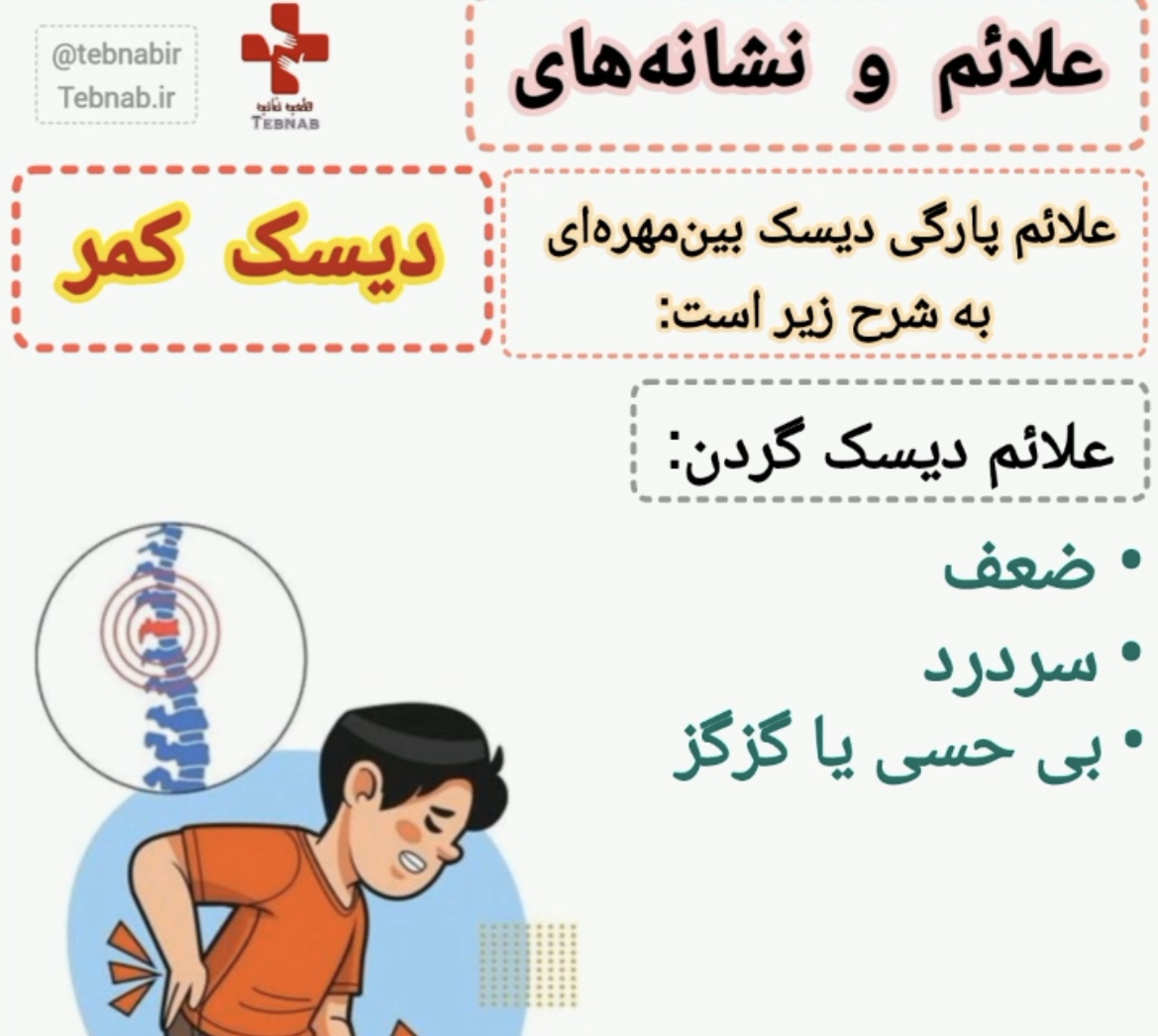 علائم دیسک کمر