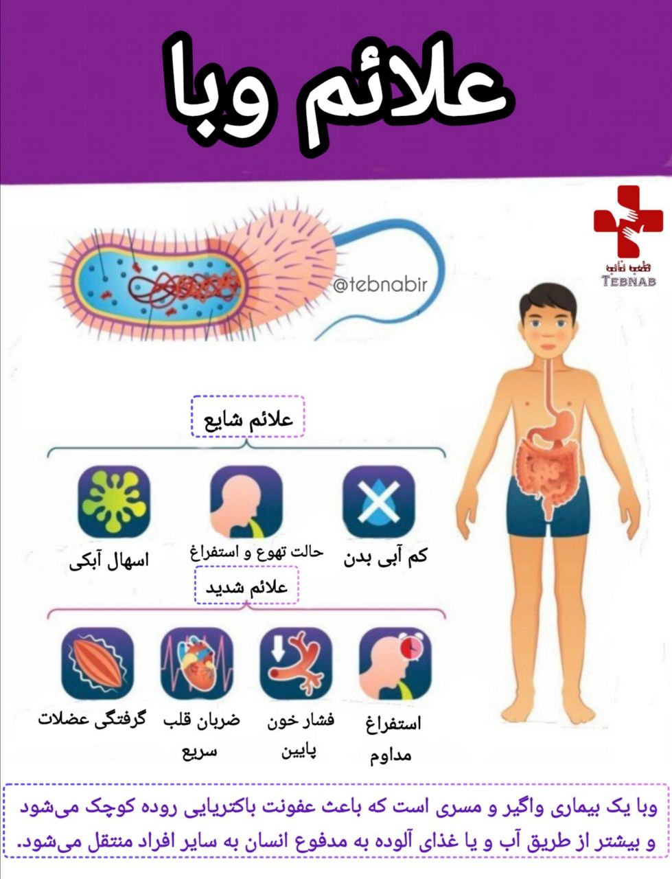 بیماری وبا