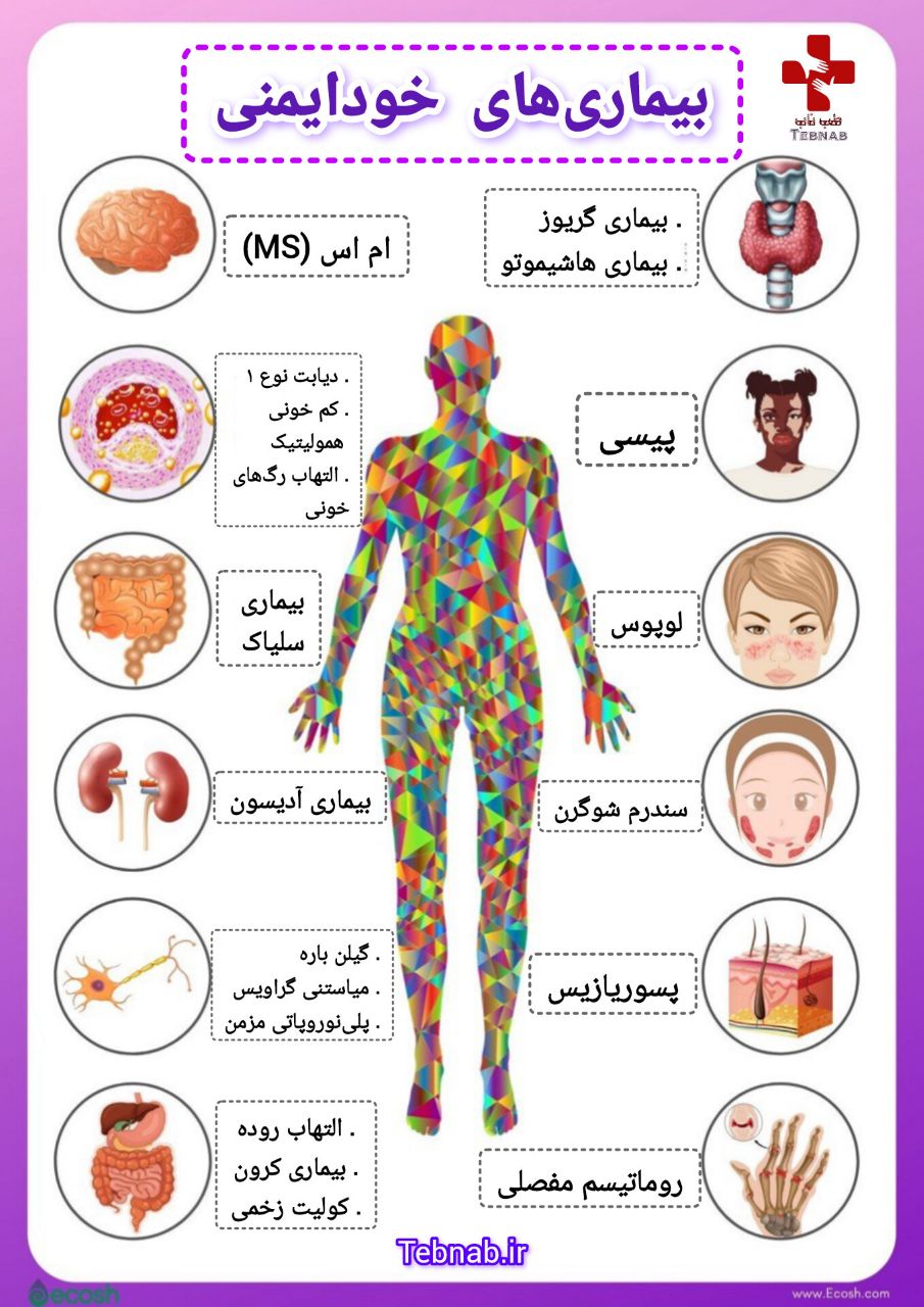 بیماری خودایمنی