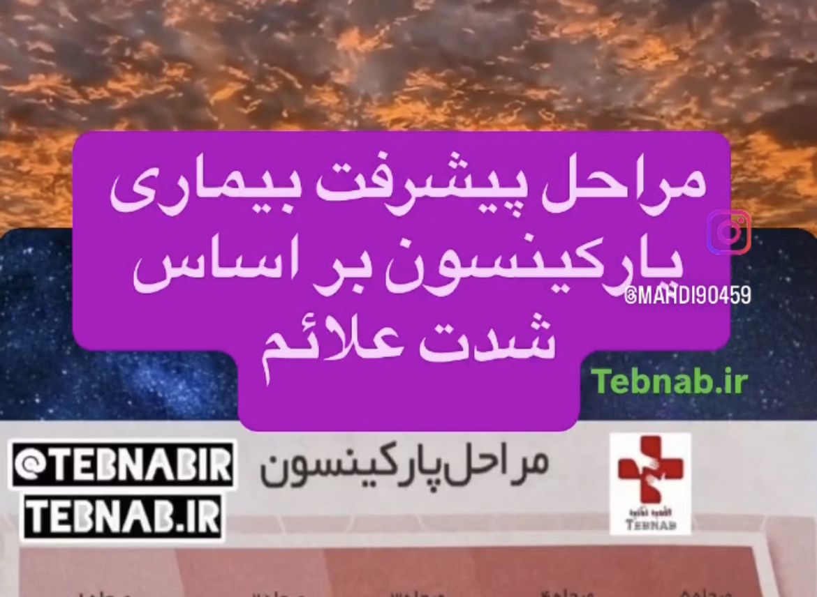 مقیاس پیشرفت پارکینسون: بهترین درمان ها