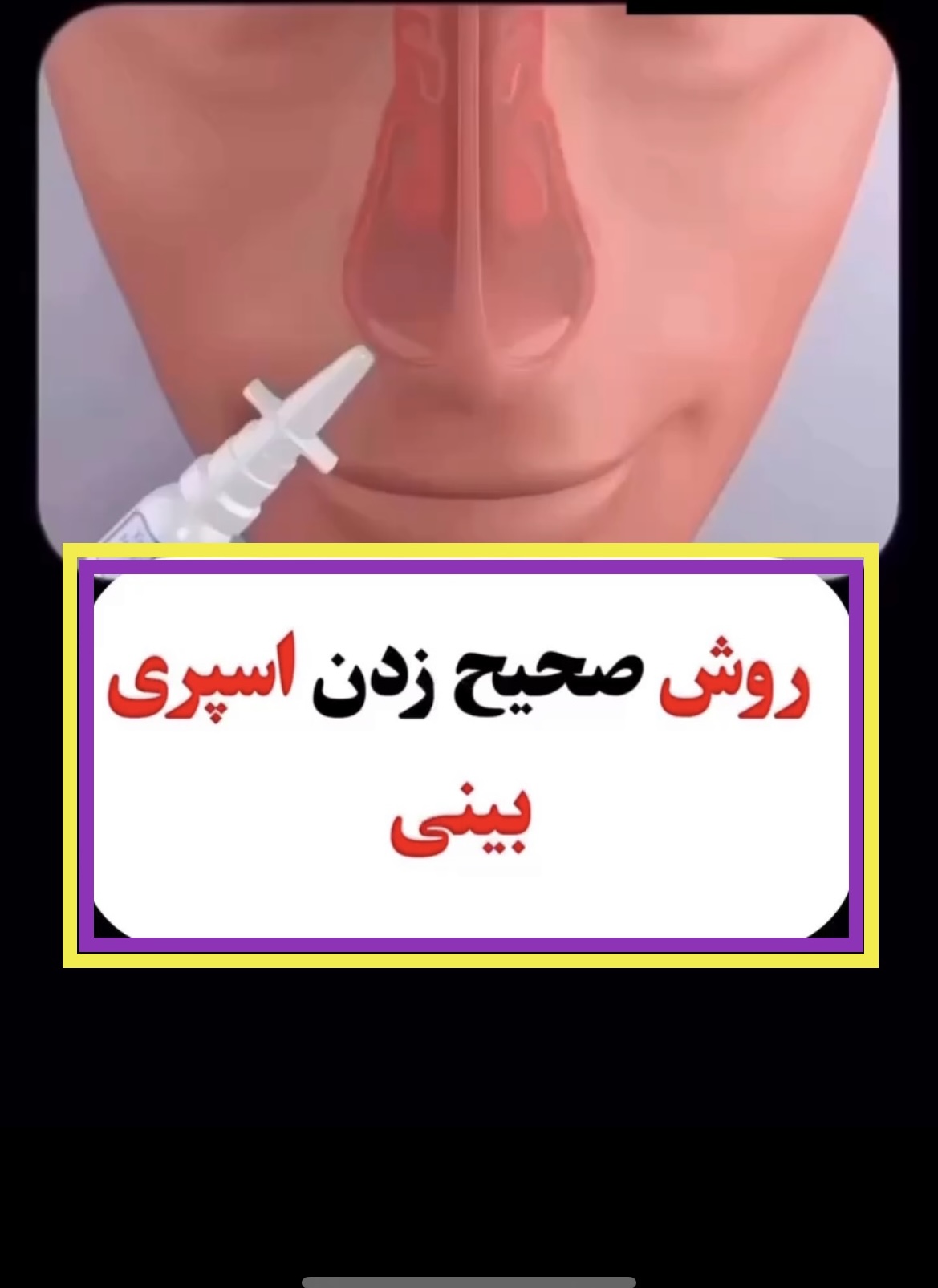 اسپری بینی رو صحیح بزن!