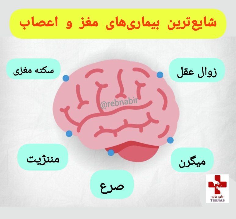 شایعترین بیماری&zwnj;های مغزی