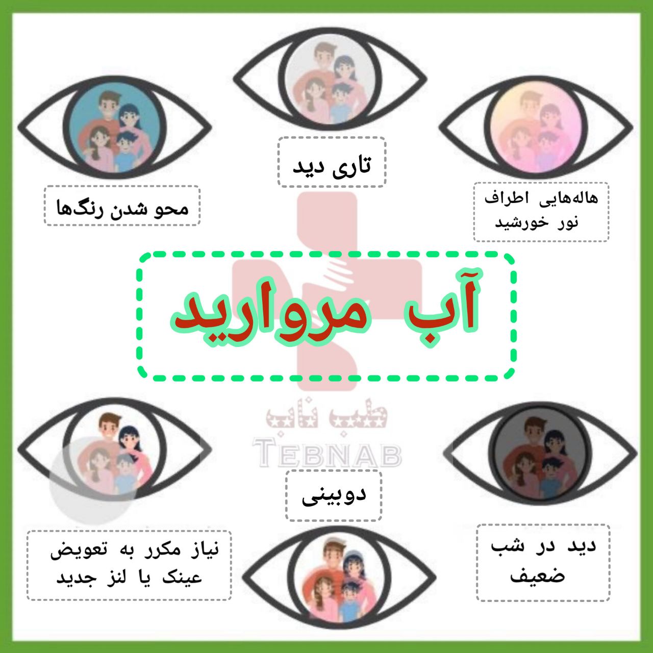 آب مروارید
