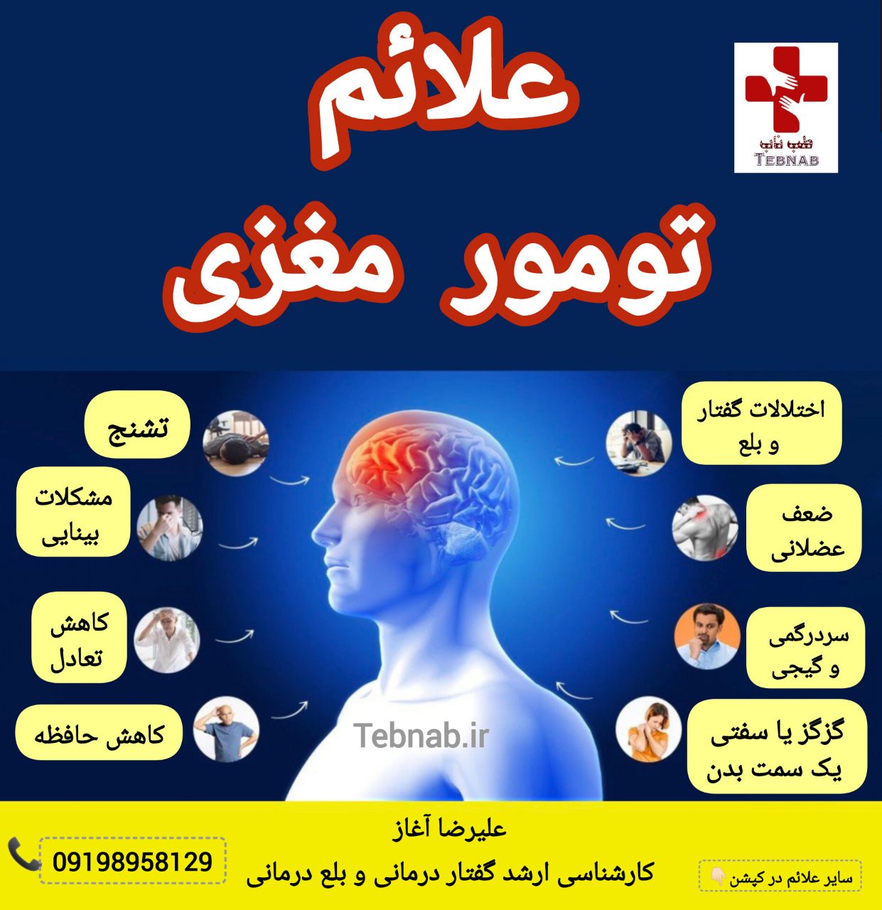 تومور مغزی: علائم
