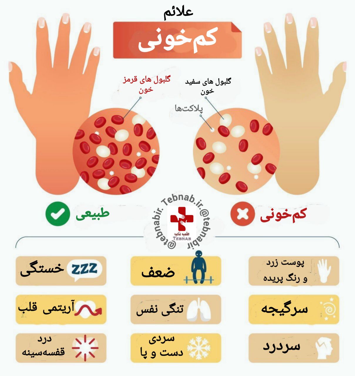 علائم کم&zwnj;خونی