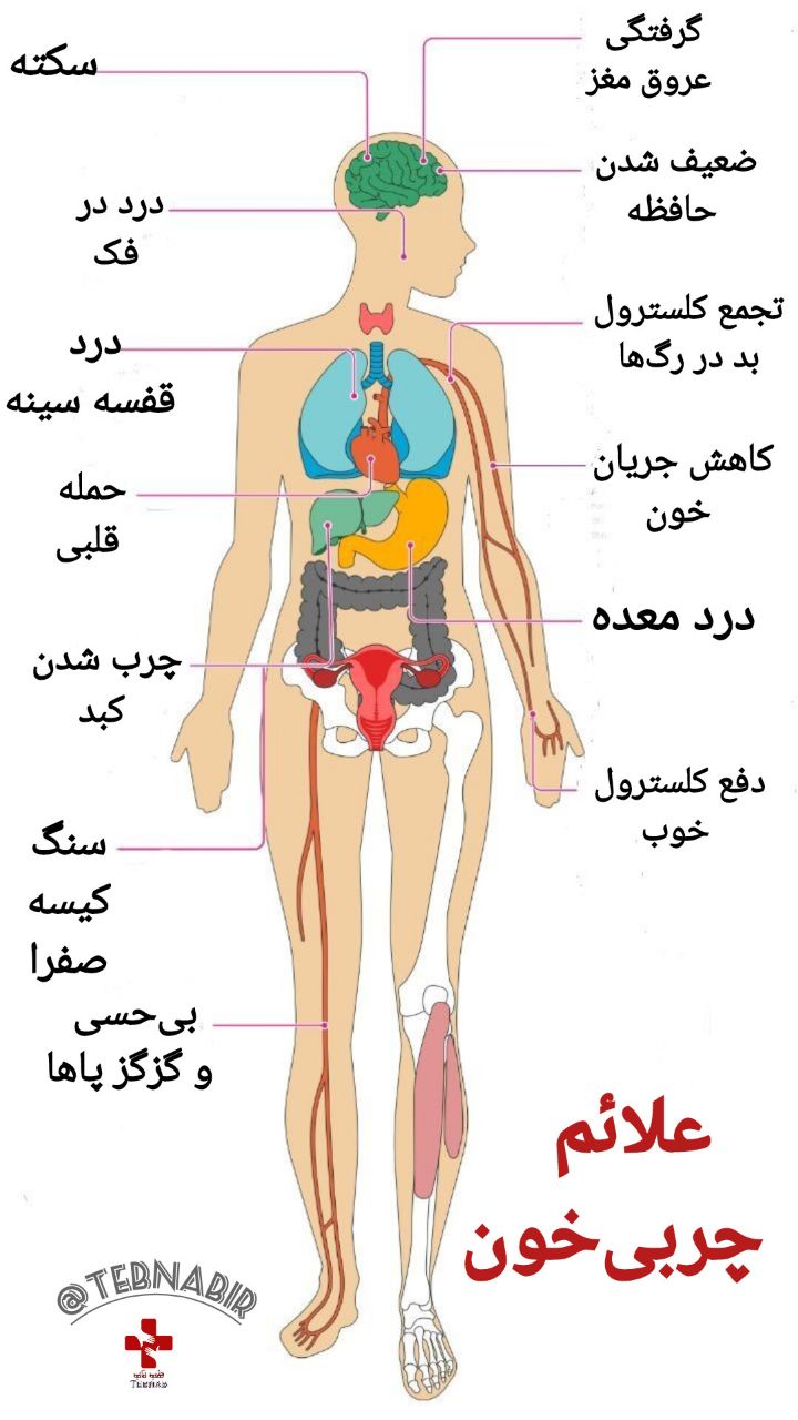 علائم چربی خون