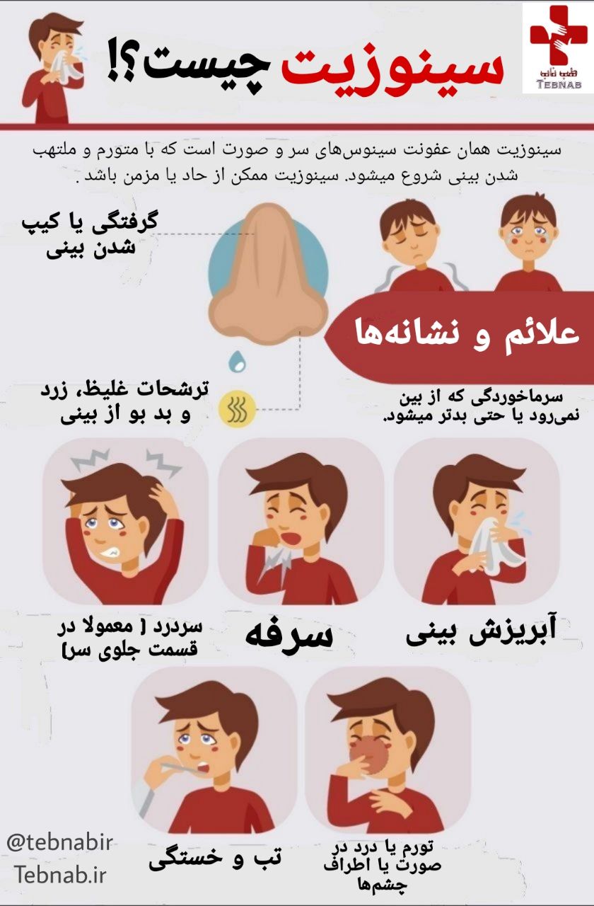 سینوزیت چیست؟!