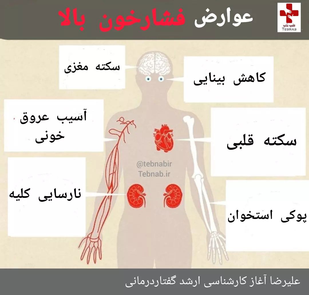 فشار خون بالا: عوارض