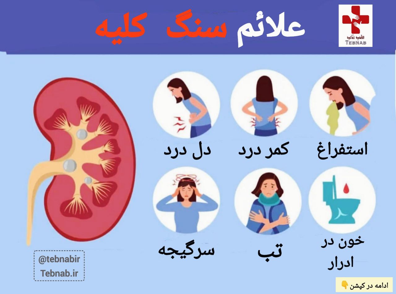 علائم سنگ کلیه